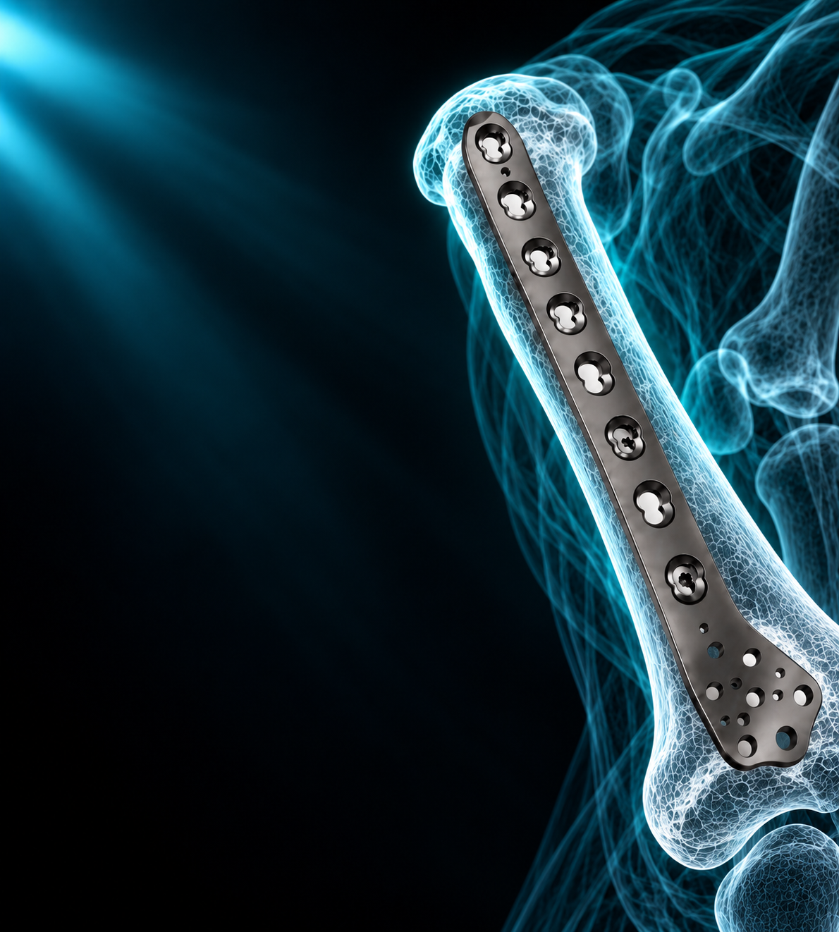 Ø5MM Lateral Distal Femur LCP