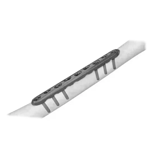 Ø5.0MM Broad LCP