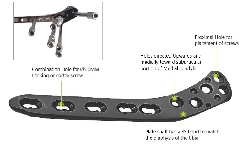 Ø5.0MM Proximal Lateral Tibia LCP