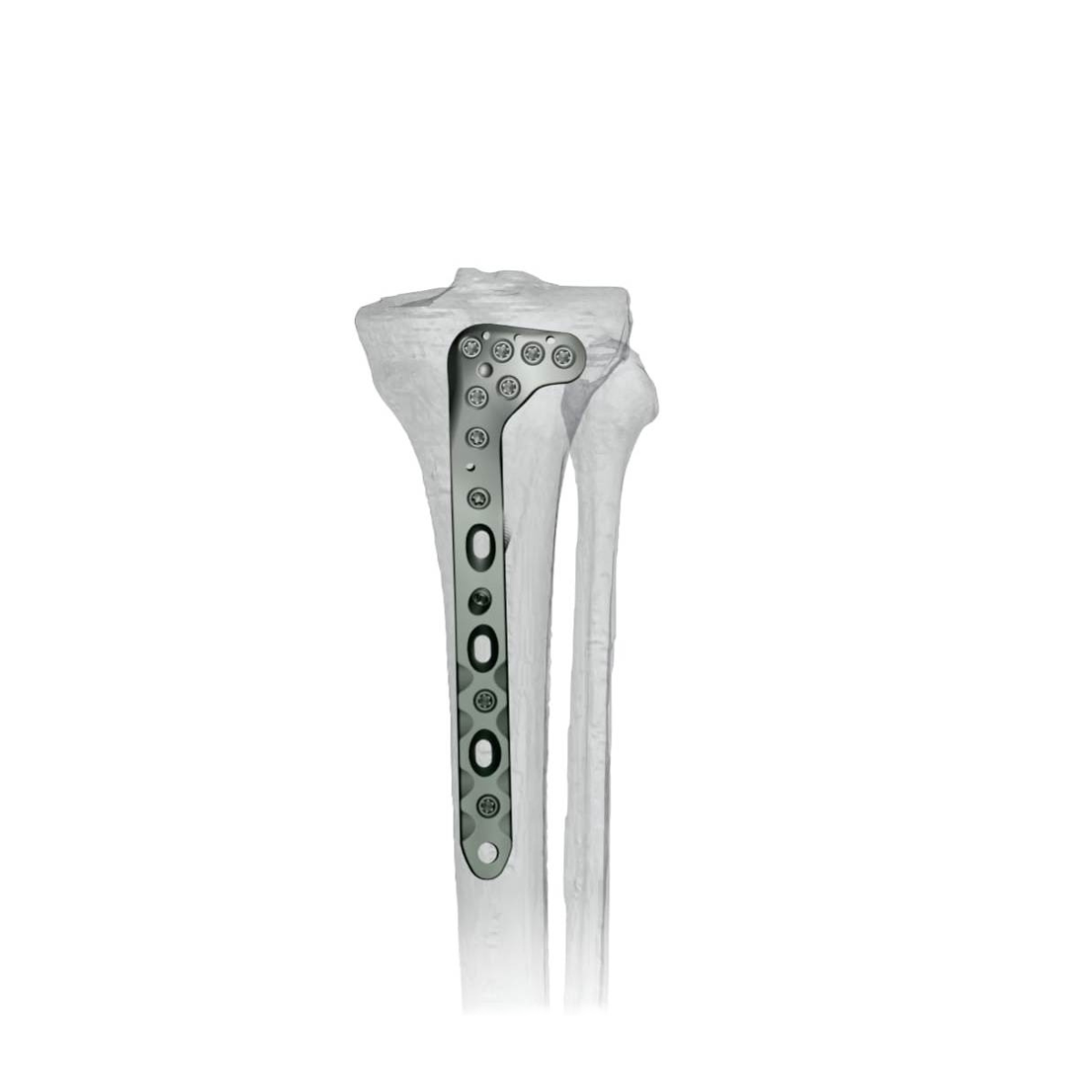 Ø3.5MM Peri Proximal Tibia Raft LCP