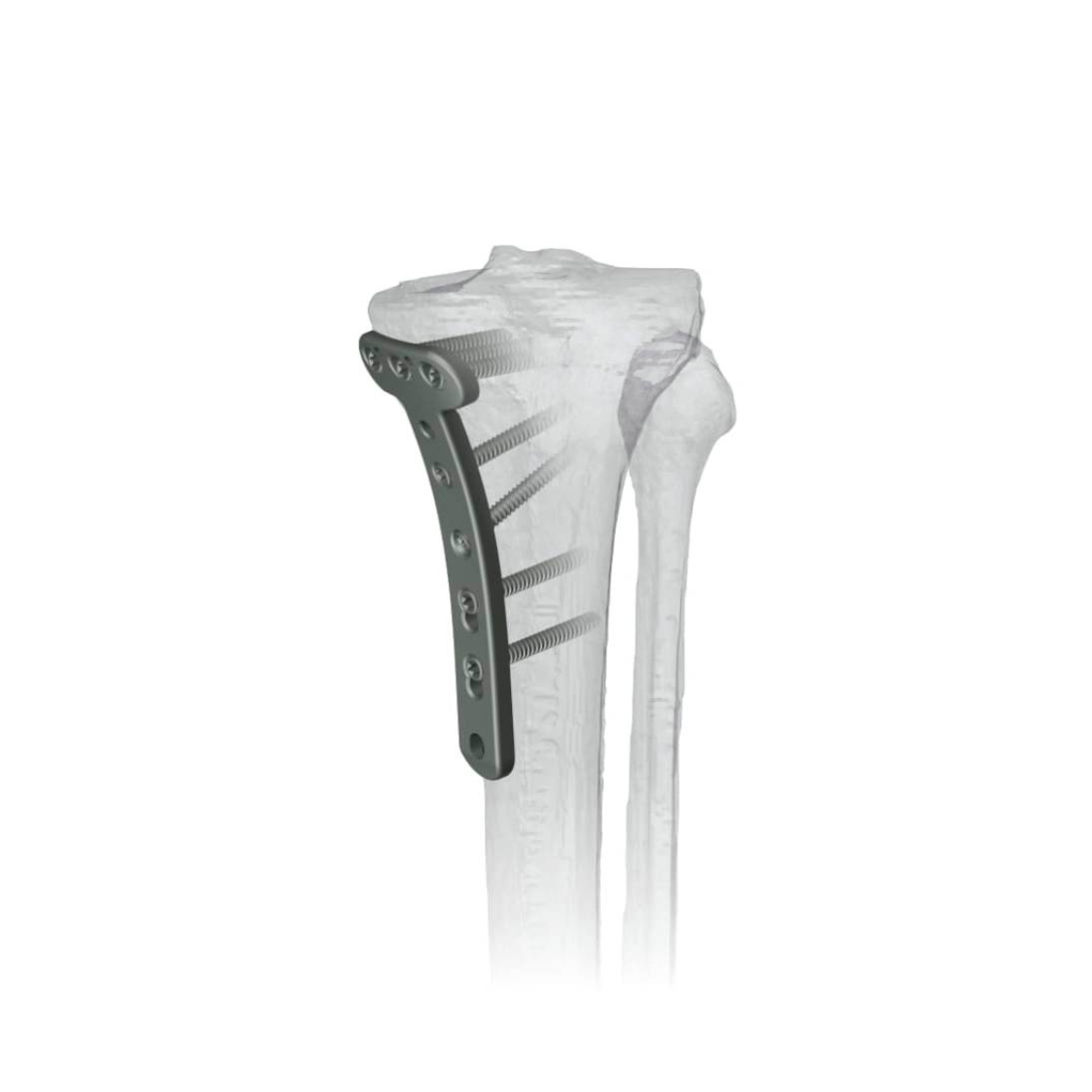 Ø3.5MM T-medial Proximal Tibia LCP